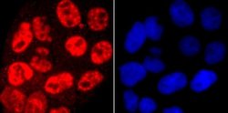 RNA Polymerase II/POLR2A (ac Ser5) Rabbit anti-Human, Mouse, Rat, Clone: